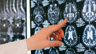 Gehirnforschung (Foto: Anna Shvets/Pexels)