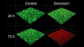 Biofilm von S. maltophilia