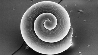Der poröse Bereich zeigt an, dass sich das Gehäuse der Flügelschnecke in einem gefährlichen Auflösungsprozess befindet (Foto: Daimler und Benz Stiftung/Nina Keul)